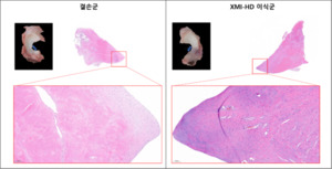 엠젠솔루션, 'XMI-HD' 전임상서 조직 재형성 가능성 확인